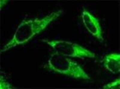 Immunocytochemistry/ Immunofluorescence: p62/SQSTM1 Antibody (2C11) [H00008878-M01]
