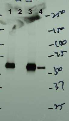 Western Blot: p62/SQSTM1 Antibody (2C11) [H00008878-M01]