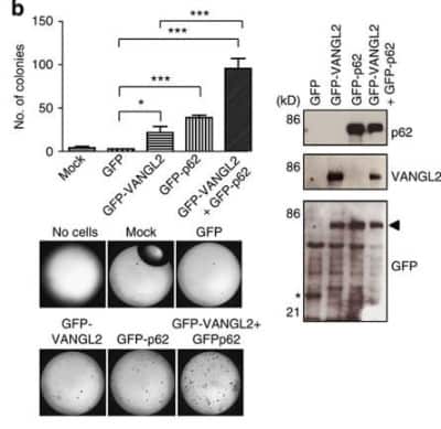 Western Blot: p62/SQSTM1 Antibody (2C11) [H00008878-M01]