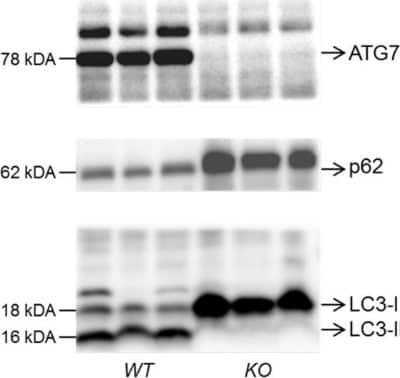 Western Blot: p62/SQSTM1 Antibody (2C11) [H00008878-M01]