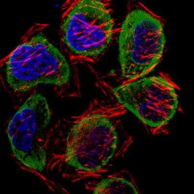 Immunocytochemistry/ Immunofluorescence: p62/SQSTM1 Antibody - BSA Free [NBP1-42821]