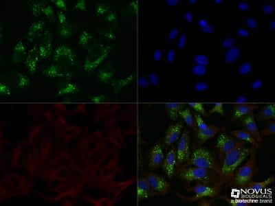 Immunocytochemistry/ Immunofluorescence: p62/SQSTM1 Antibody - BSA Free [NBP1-48320]