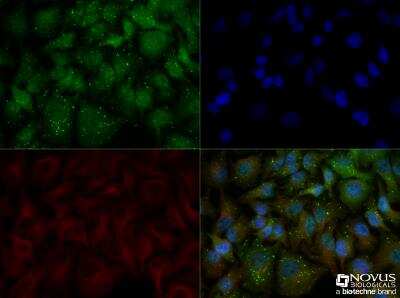 Immunocytochemistry/ Immunofluorescence: p62/SQSTM1 Antibody - BSA Free [NBP1-48320]