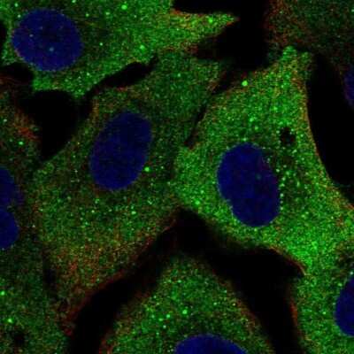 Immunocytochemistry/ Immunofluorescence: p62/SQSTM1 Antibody [NBP2-56317]