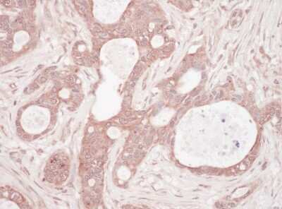 Immunohistochemistry-Paraffin: p62/SQSTM1 Antibody [NBP1-49954]