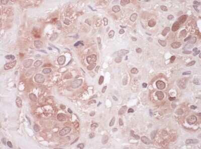 Immunohistochemistry-Paraffin: p62/SQSTM1 Antibody [NBP1-49956]