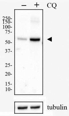 Western Blot: p62/SQSTM1 AntibodyBSA Free [NBP1-42822]