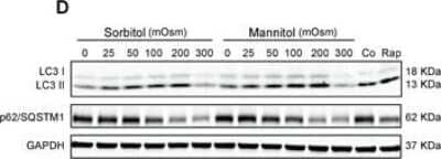 Western Blot: p62/SQSTM1 AntibodyBSA Free [NBP1-42822]
