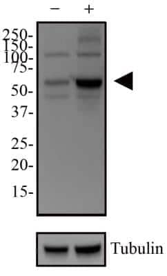 Western Blot: p62/SQSTM1 AntibodyBSA Free [NBP1-48320]