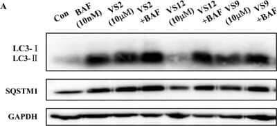 Western Blot: p62/SQSTM1 AntibodyBSA Free [NBP1-48320]