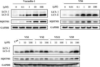 Western Blot: p62/SQSTM1 AntibodyBSA Free [NBP1-48320]