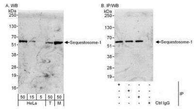 Western Blot: p62/SQSTM1 Antibody [NBP1-49954]