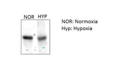 Western Blot: p62/SQSTM1 Antibody [NBP1-49954]