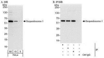 Western Blot: p62/SQSTM1 Antibody [NBP1-49955]