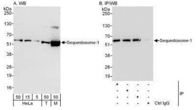 Western Blot: p62/SQSTM1 Antibody [NBP1-49956]
