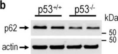 Western Blot: p62/SQSTM1 Antibody [NBP1-49956]