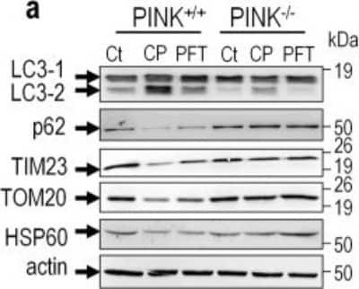 Western Blot: p62/SQSTM1 Antibody [NBP1-49956]