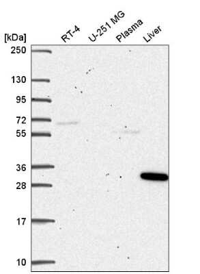 Western Blot: p62/SQSTM1 Antibody [NBP2-56317]