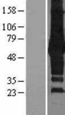 Western Blot: p62/SQSTM1 Overexpression Lysate [NBL1-16446]