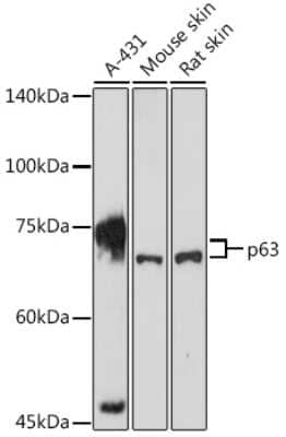 Western Blot: p63/TP73L AntibodyAzide and BSA Free [NBP2-93323]