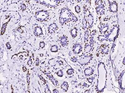 Immunohistochemistry-Paraffin: p63/TP73L Antibody (143) [NBP2-89212]