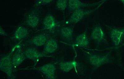 Immunodiffusion: p63/TP73L Antibody (C24-I) [NBP3-08204]
