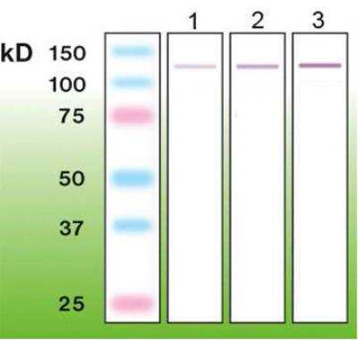 Western Blot: p63/TP73L Antibody (C24-I) [NBP3-08204]