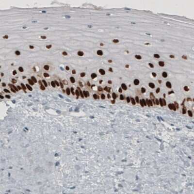Immunohistochemistry-Paraffin: p63/TP73L Antibody (CL3748) [NBP3-05501]