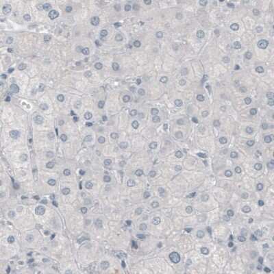 Immunohistochemistry-Paraffin: p63/TP73L Antibody (CL3748) [NBP3-05501]