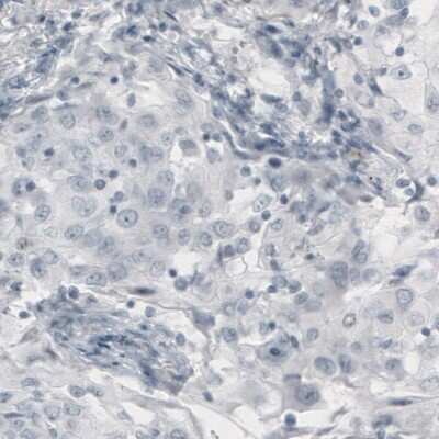 Immunohistochemistry-Paraffin: p63/TP73L Antibody (CL3748) [NBP3-05501]