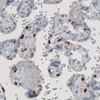 Immunohistochemistry-Paraffin: p63/TP73L Antibody (CL3748) [NBP3-05501]