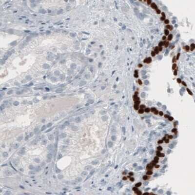 Immunohistochemistry-Paraffin: p63/TP73L Antibody (CL3748) [NBP3-05501]