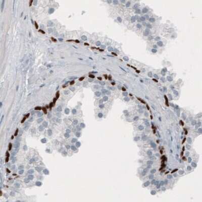Immunohistochemistry-Paraffin: p63/TP73L Antibody (CL3748) [NBP3-05501]
