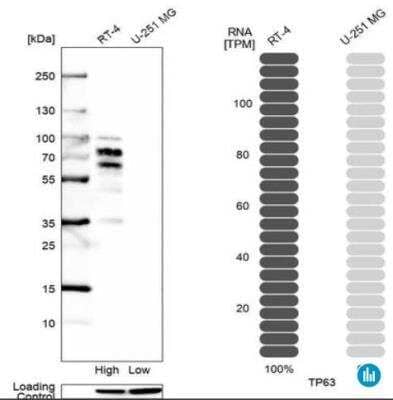 Western Blot: p63/TP73L Antibody (CL3748) [NBP3-05501]