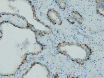 Immunohistochemistry-Paraffin: p63/TP73L Antibody (I27-I) [NBP3-08205]