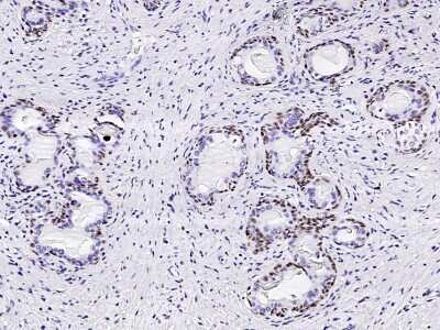 Immunohistochemistry-Paraffin: p63/TP73L Antibody [NBP2-95281]