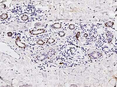 Immunohistochemistry-Paraffin: p63/TP73L Antibody [NBP2-95281]