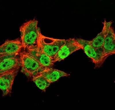 Immunocytochemistry/ Immunofluorescence: p63/TP73L Antibody (TP40/3980R) - Azide and BSA Free [NBP3-08775]