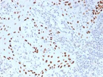 Immunohistochemistry-Paraffin: p63/TP73L Antibody (TP40/3980R) [NBP3-07453]