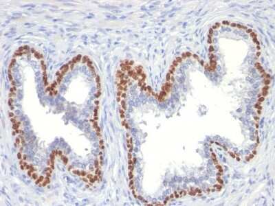 Immunohistochemistry-Paraffin: p63/TP73L Antibody (TP63/11) [NBP3-07431]