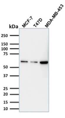 Western Blot: p63/TP73L Antibody (TP63/1786) [NBP3-07441]