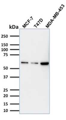 Western Blot: p63/TP73L Antibody (TP63/1786)Azide and BSA Free [NBP3-08734]