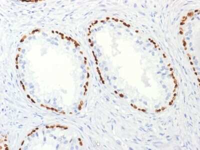 Immunohistochemistry-Paraffin: p63/TP73L Antibody (TP63/2427) [NBP3-07442]