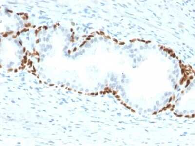 Immunohistochemistry-Paraffin: p63/TP73L Antibody (TP63/2428) - Azide and BSA Free [NBP3-08736]