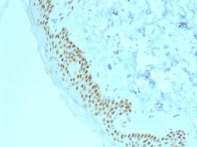 Immunohistochemistry-Paraffin: p63/TP73L Antibody (TP63/2428) - Azide and BSA Free [NBP3-08736]