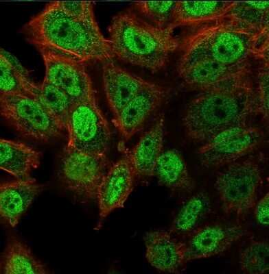 Immunocytochemistry/ Immunofluorescence: p63/TP73L Antibody (ZR8) - Azide and BSA Free [NBP3-08776]