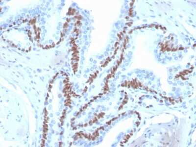 Immunohistochemistry-Paraffin: p63/TP73L Antibody (ZR8) [NBP3-07454]
