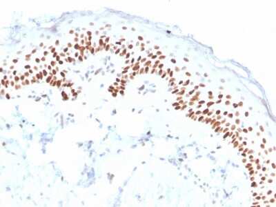 Immunohistochemistry-Paraffin: p63/TP73L Antibody (ZR8) [NBP3-07454]