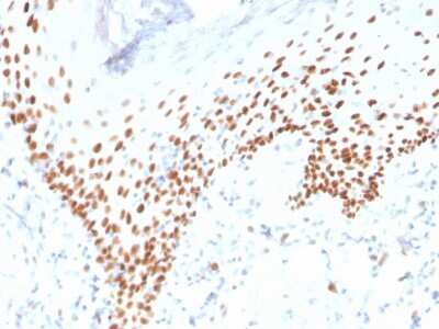 Immunohistochemistry-Paraffin: p63/TP73L Antibody (rTP40/3690) - Azide and BSA Free [NBP3-08660]