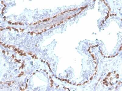 Immunohistochemistry-Paraffin: p63/TP73L Antibody (rTP40/3690) - Azide and BSA Free [NBP3-08660]